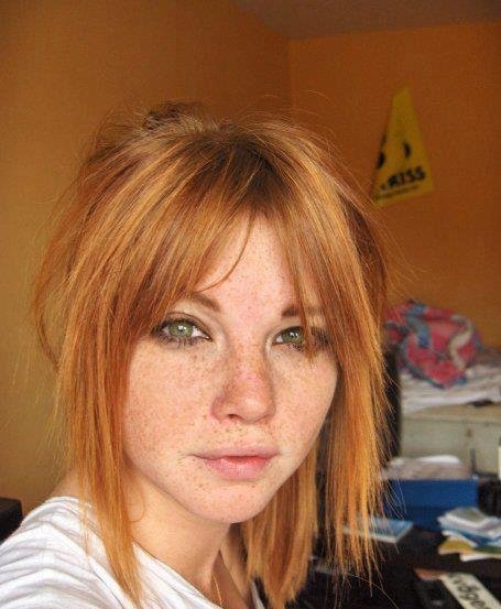 Ginger freckles